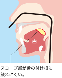 経鼻内視鏡検査